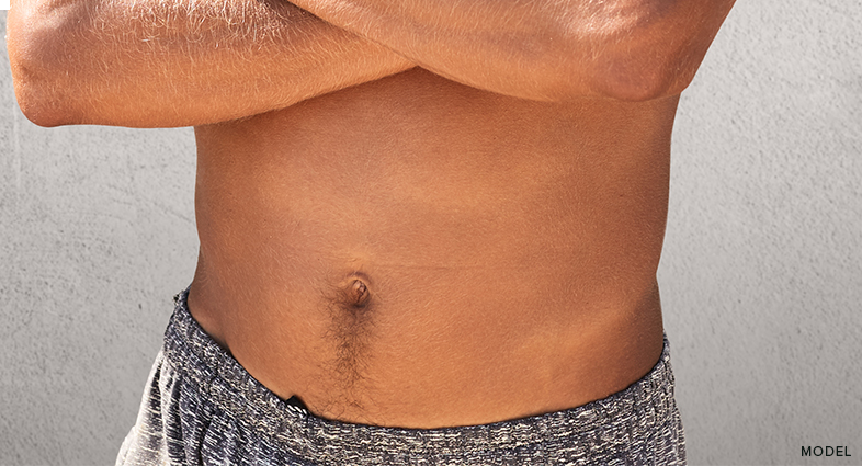 tummy tuck for men