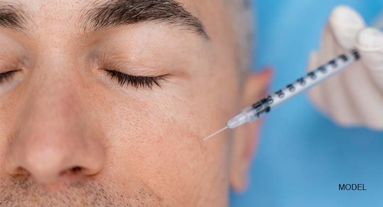 Micro-Needling for Acne Scars