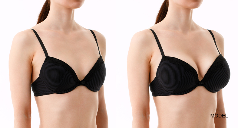 breast lift vs breast reduction