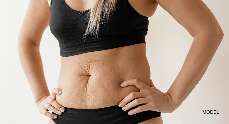 Lumps After Liposuction