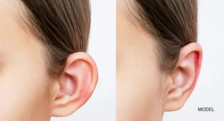 Different Types of Ears